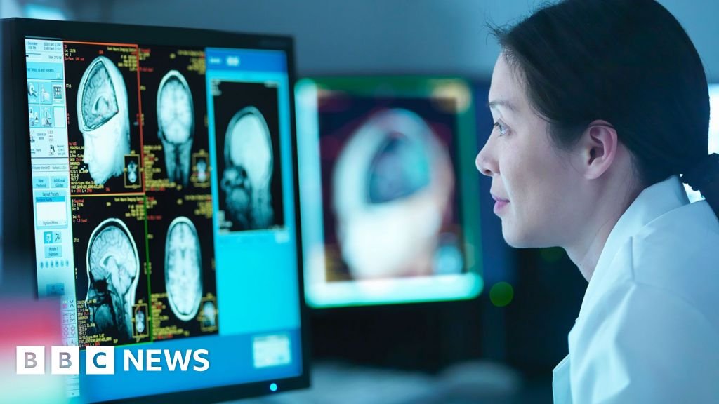 Menopause linked to Alzheimer’s-like brain changes