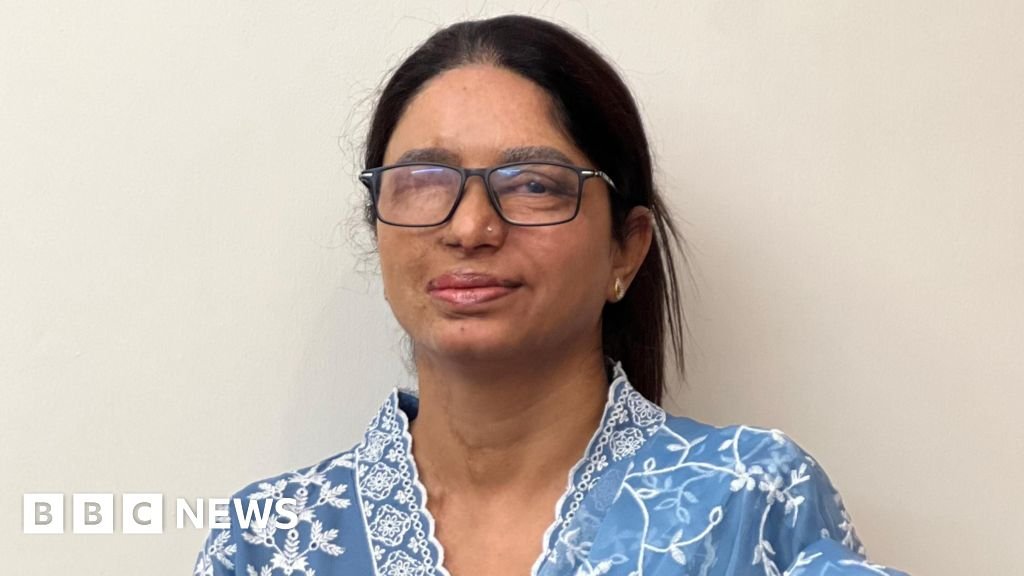 'We are treated as outcasts': Acid attack survivor fights for justice and dignity