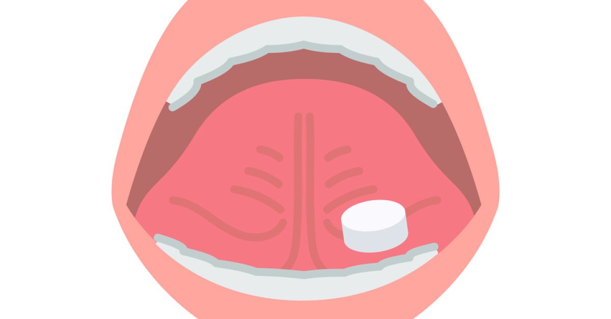 Dil altı hapı orucu bozar mı? Diyanet’e göre oruçluyken dil altı hapı kullanmak orucu bozar mı?